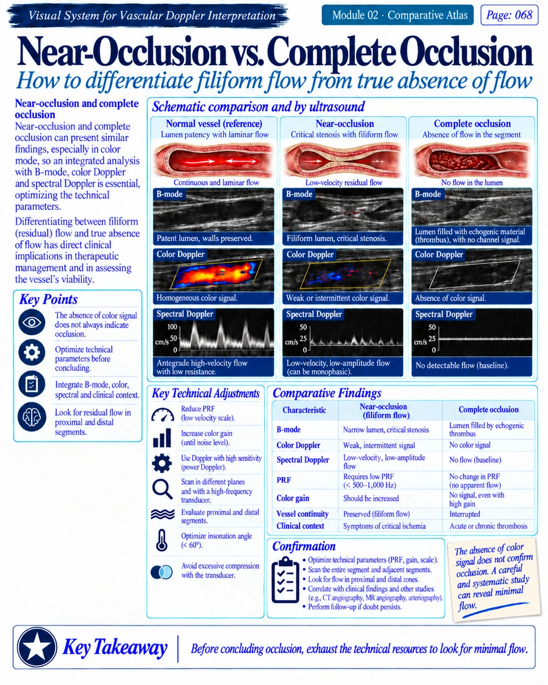 Page 68: Near-occlusion vs. complete occlusion. English preview of the digital vascular Doppler material.