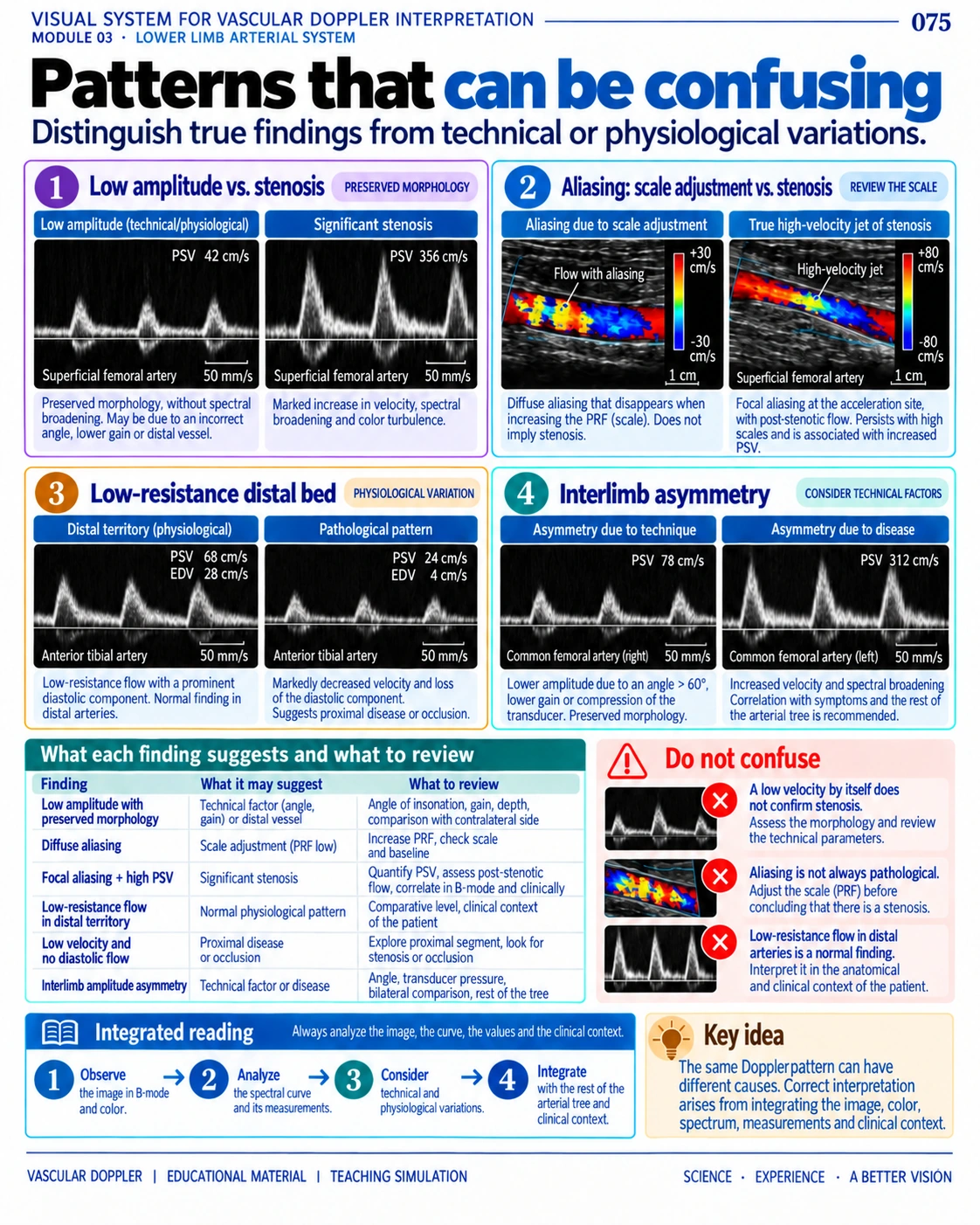 Page 75: Potentially misleading patterns. English preview of the digital vascular Doppler material.